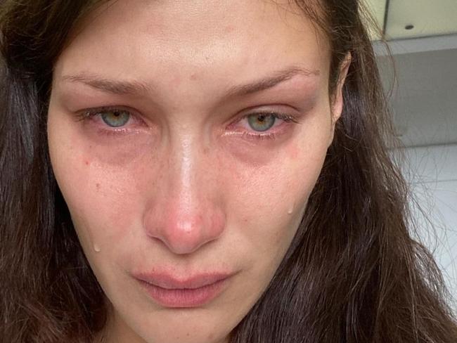 Bella Hadid detailed her "excrutiating" struggle with mental health. Picture: Instagram/bellahadid