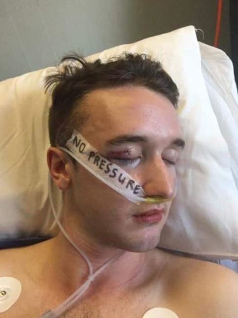 Mr McNab still hasn’t regained feeling in the right side of his face. Picture: Facebook/Andrew McNab