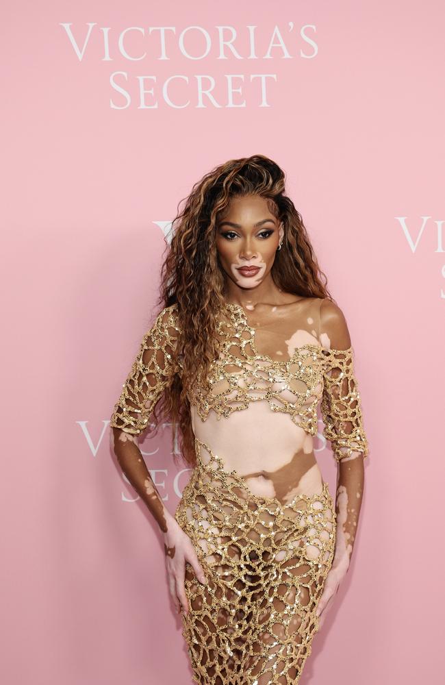 Winnie Harlow, who walked for Victoria’s Secret in 2018, has returned to the brand. Picture: Getty Images for Victoria's Secret