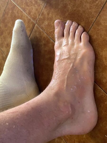 Australian actor Luke Cook’s feet. He raised more than $10k for charity selling images of his feet to fans.