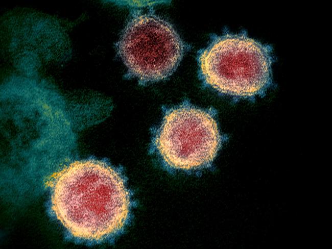 A microscopic image from 2020 showing SARS-CoV-2, the virus that causes Covid-19. Picture: National Institutes of Health/AFP