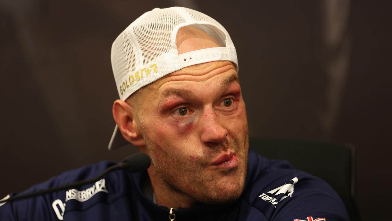 Tyson Fury speaks to the media during a post fight press conference following his loss to Oleksandr Usyk. (Photo by Richard Pelham/Getty Images)