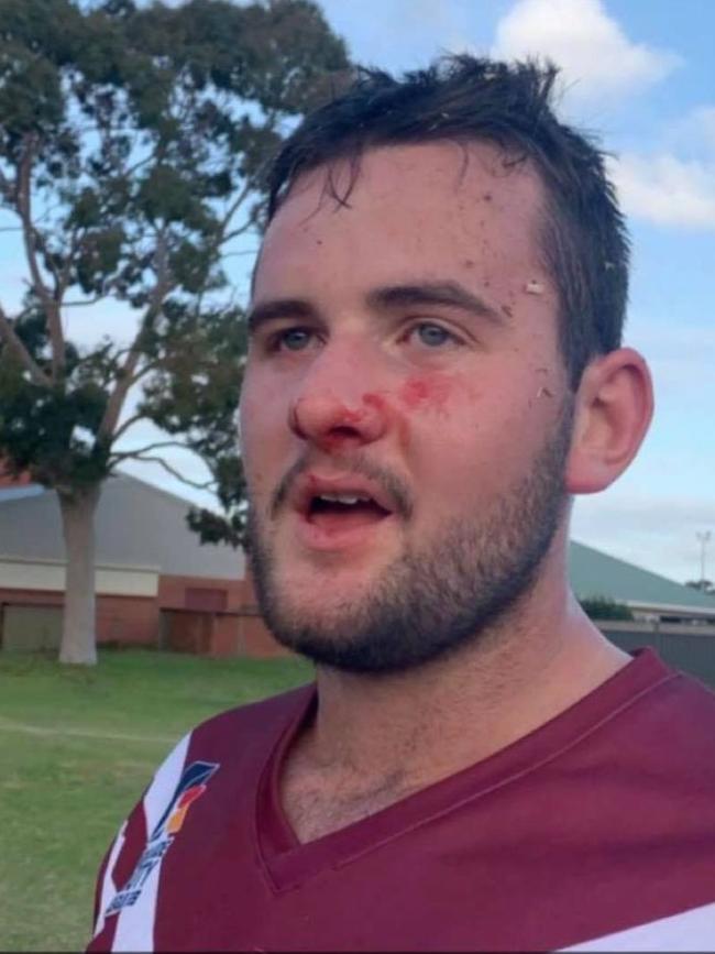 Colonel Light Gardens player Bryce Smith after smothering the ball with his face to win the game on Saturday. Picture: Supplied