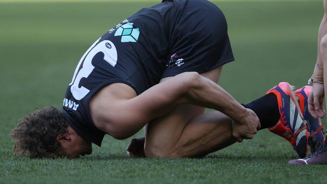 MELBOURNE, AUSTRALIA - AUGUST 11: Charlie Curnow of the Blues reacts after sustaining an injury during the round 22 AFL match between Carlton Blues and Hawthorn Hawks at Melbourne Cricket Ground, on August 11, 2024, in Melbourne, Australia. (Photo by Daniel Pockett/Getty Images)