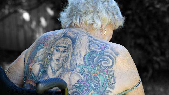 Chloe Callander talks about her scars. Picture: Tony Martin