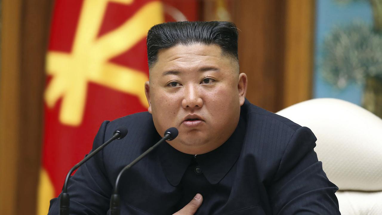 There is intense speculation about Kim Jong-un’s health. Picture: AP