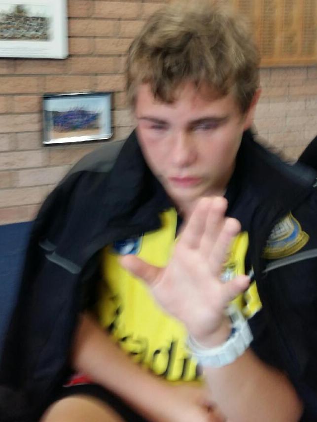 Kurt Portsmouth, 16, suffered facial injuries after the alleged attack.