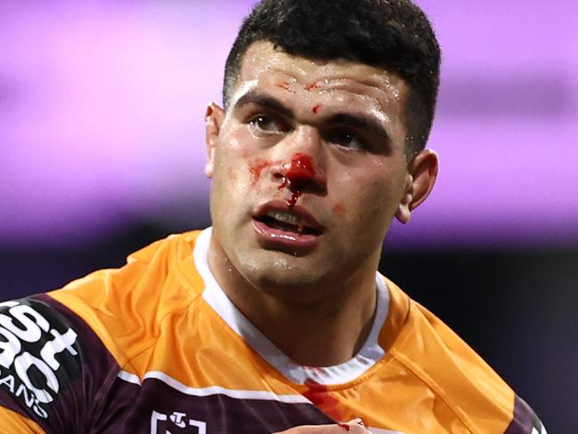 SYDNEY, AUSTRALIA - AUGUST 28:  David Fifita of the Broncos is seen with a bloody nose during the round 16 NRL match between the Sydney Roosters and the Brisbane Broncos at the Sydney Cricket Ground on August 28, 2020 in Sydney, Australia. (Photo by Cameron Spencer/Getty Images)