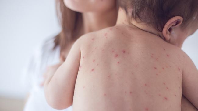 It turns out all those infections kids carry around are good for parents. Picture: iStock