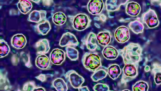 The measles virus, paramyxoviridae from the Morbillivirus family, transmission microscopy view. (Photo by: BSIP/Universal Images Group via Getty Images)