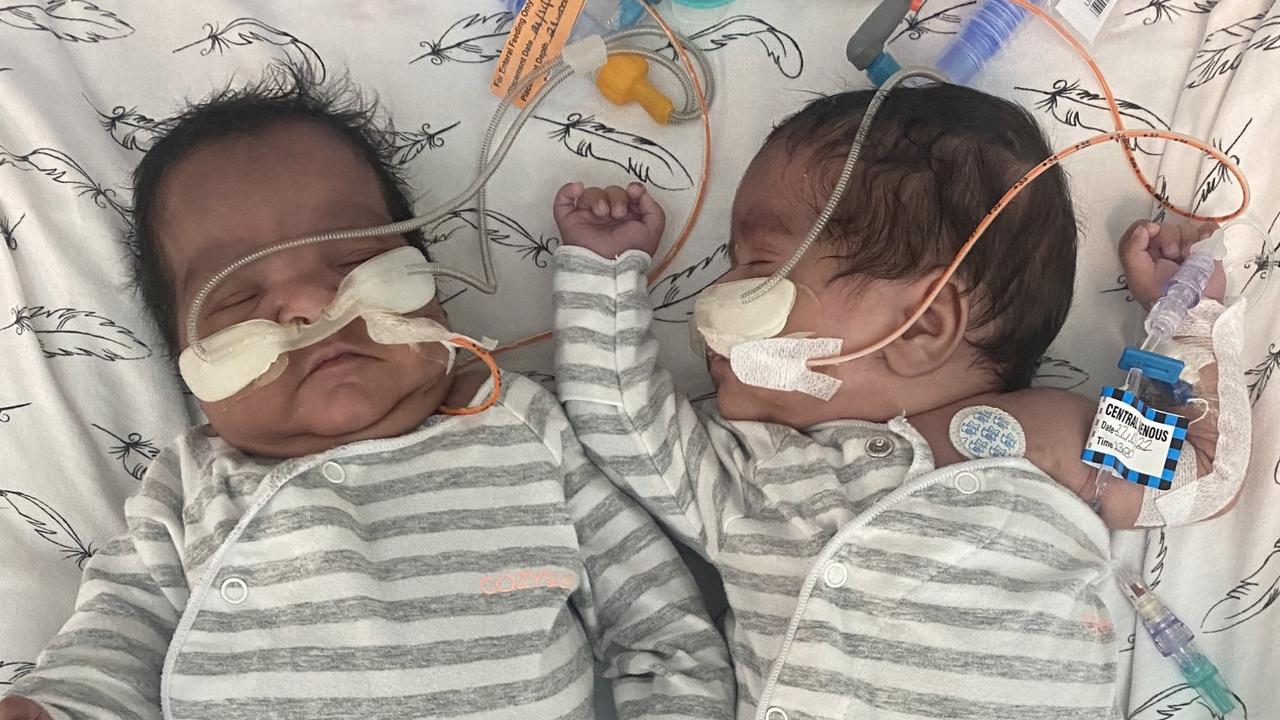 Miracle babies celebrate first Christmas at home after 100 days in hospital. Picture: Supplied