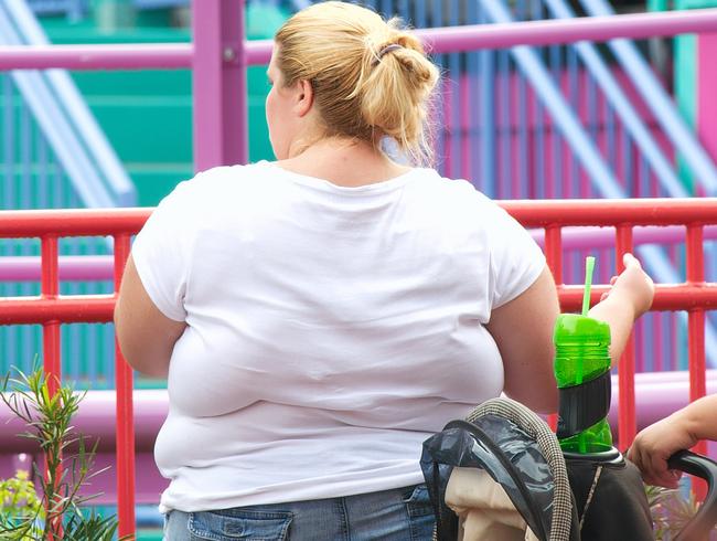 Eight out of ten people undergoing obesity surgery are women in their 40s.