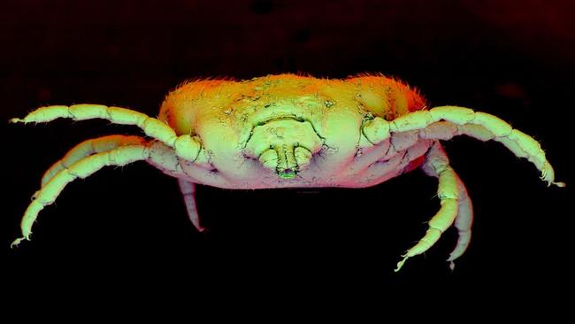 Electron Microscope images of a tick.