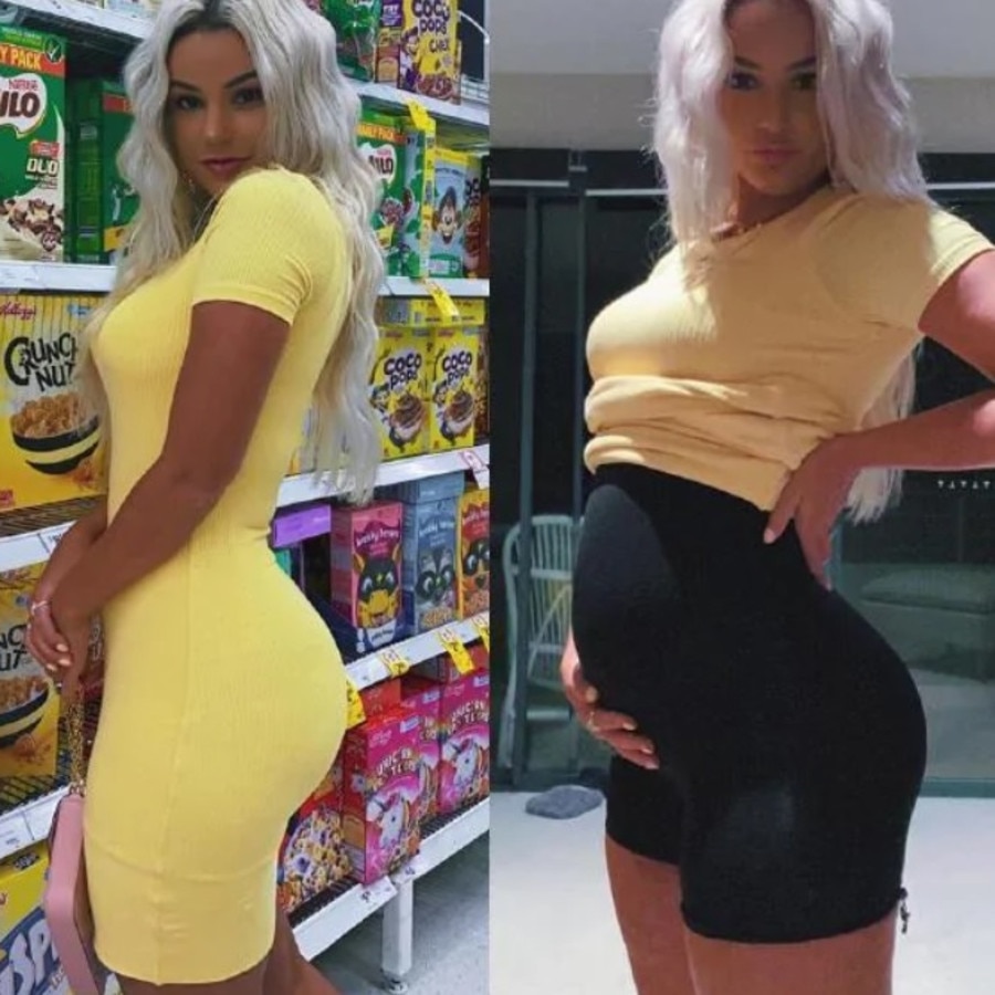 Bikini Model’s ‘amazing’ Booty Transformation Au — Australia