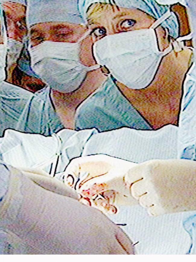 The late Diana Princess of Wales watches a four-hour heart operation performed at the Harefield Hospital in 1992.