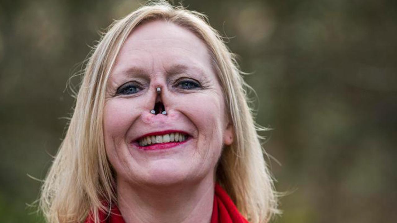 Why Does This Broken Lady Dress Like Man Woman explains what it’s like to live with prosthetic nose | news.com