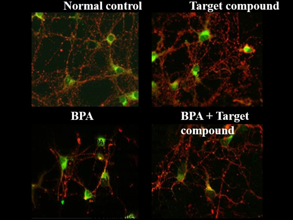 Microscope slides showing how a target compound has an opposing effect on BPA. Top row: left – neuron cell culture with normal cells, with the top left showing a usual pattern of neurons. Top row: right – cells treated with a compound that was the subject of the study. Bottom row: left – cells subjected to BPA showing decreased spine density (red dots) and shortened neurites (red lines). Bottom row: right – This was not seen when the target compound was also added.