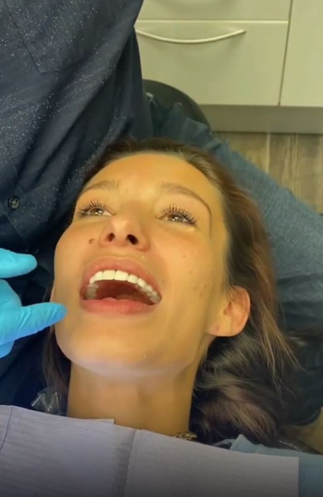 Brittany after her $38,000 new set of dentures. Picture: TikTok/brittanynegler