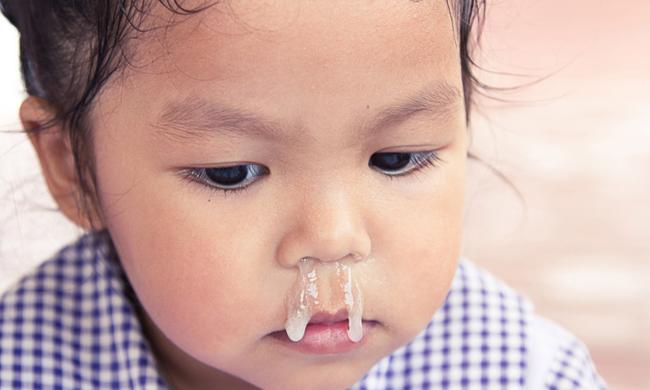 It's not always bout the green snot. Image: iStock