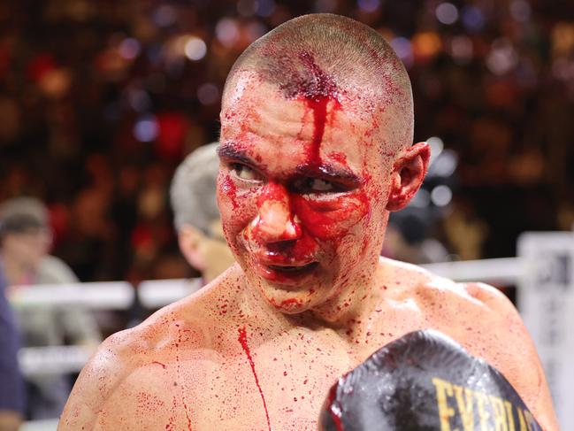 LAS VEGAS, NEVADA - MARCH 30: WBO junior middleweight champion Tim Tszyu (L) walks to his corner after a 12-round fight against Sebastian Fundora at T-Mobile Arena on March 30, 2024 in Las Vegas, Nevada. Fundora won Tszyu's title and a vacant WBC title by split decision. (Photo by Steve Marcus/Getty Images)