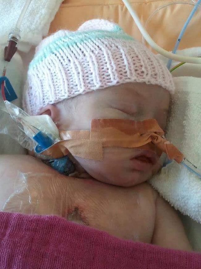 Abigail Baker in hospital as a newborn.