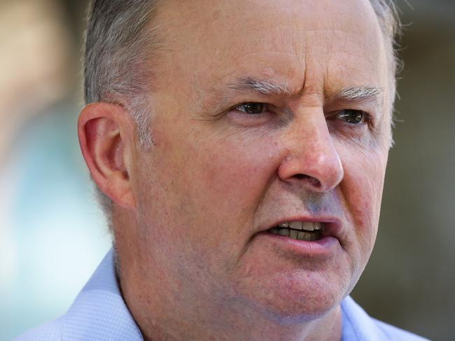 SYDNEY, AUSTRALIA - JANUARY 09, 2021: Anthony Albanese Leader of the Opposition and Leader of the Labor Party is seen leaving the RPA Hospital today after a car accident yesterday in Marrickville in Sydney, Australia. Picture: Newscorp - Sunday Telegraph / Gaye Gerard