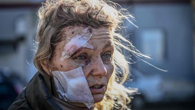 A wounded woman stands outside a hospital after the bombing of the eastern Ukraine town of Chuguiv. Picture: Aris Messinis/AFP