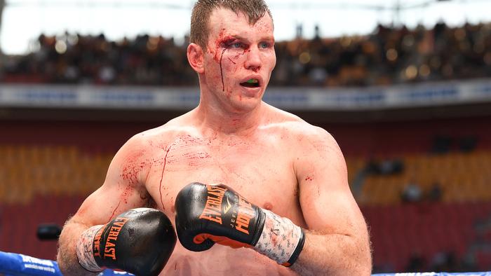 Jeff Horn of Australia looks on during the WBO World Welterweight Title fight at Suncorp Stadium in Brisbane, Sunday, July 2, 2017. (AAP Image/Dave Hunt) NO ARCHIVING, EDITORIAL USE ONLY