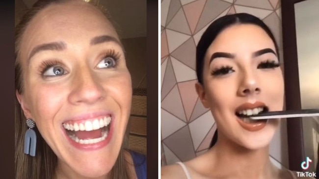 A dental surgeon has lashed TikTok creators behind viral teeth whitening and straightening ‘hacks’ putting viewers in harm’s way.