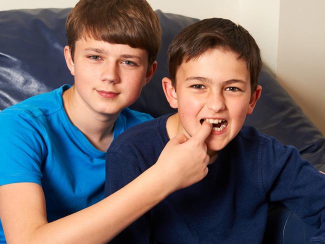 Harry, 13 and Charlie, 11 Davies-Carr celebrate 10 years of their viral video fame. Picture: Caters