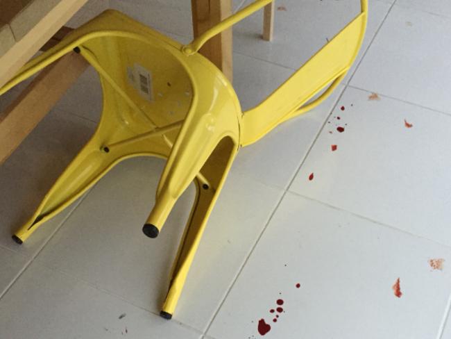 The scene in Mr Bulman’s kitchen after he hit his foot on the Fantastic Furniture Worx chair. Picture: Supplied