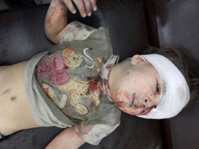Daqneesh after receiving treatment. Picture: Aleppo Media Center