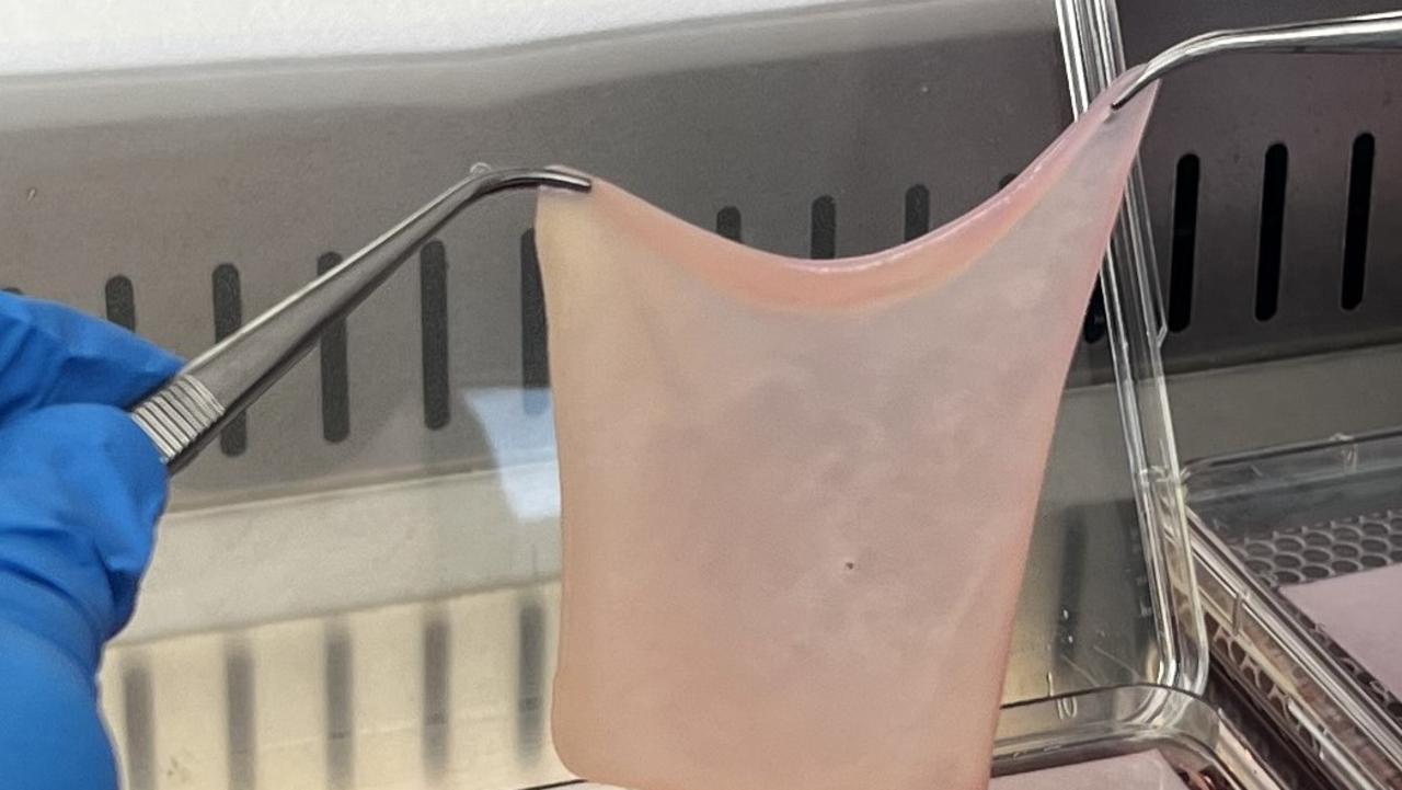 The artificial tissue mimics the crucial top layers of skin and comes after years of work at The Alfred and Monash University. Picture: supplied