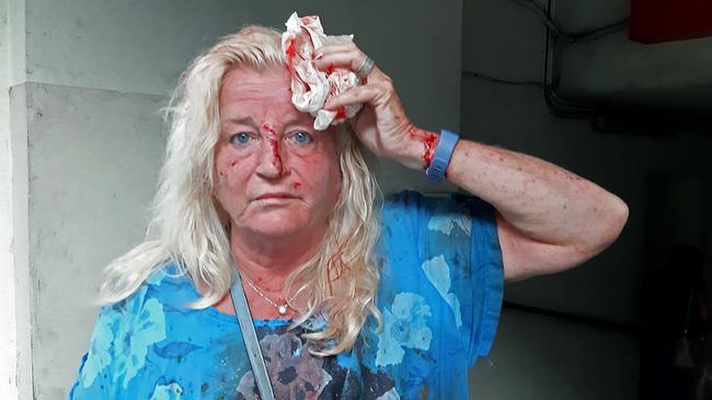 Valarie Fakhoury, a British-Lebanese national, stands outside the emergency ward of a hospital in central Beirut following a huge explosion that rocked the Lebanese capital. Picture: AFP