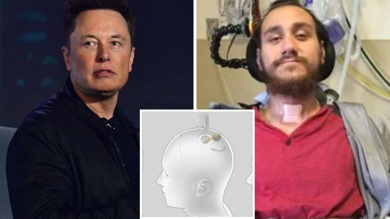 “Duramıyorum”: Bir adam, Elon Musk'un Neuralink beyin implantının varlığı hakkındaki gerçeği ortaya koyuyor