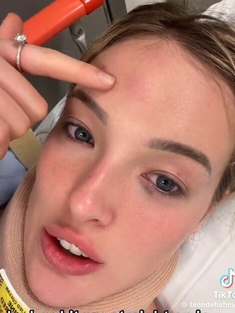 Influencer Millie Hannah ‘king hit’ in Surfers Paradise. Photo: TikTok/@blondebabey00