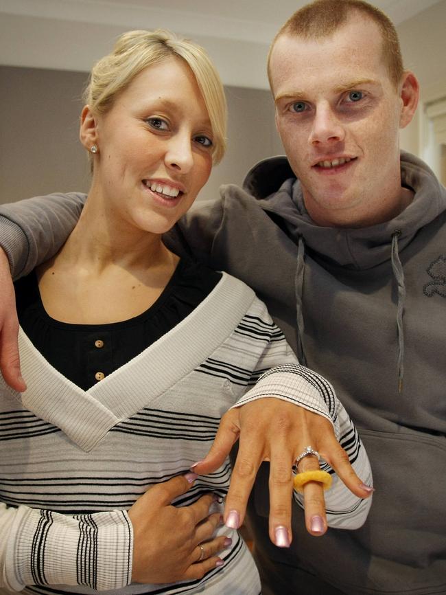 Haylea McCann wears the burger ring chip snack that Brownlow Medal winner Adam Cooney used when he proposed marriage to her.