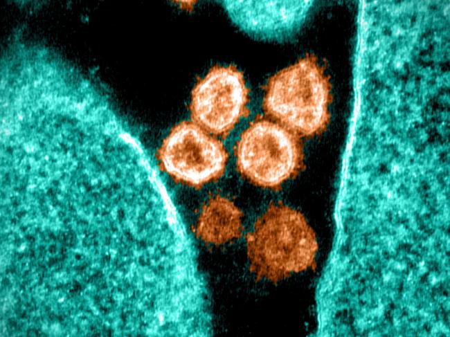 This undated transmission electron microscope handout image obtained June 28, 2021 courtesy of the National Institue of Allergy and Diseases shows SARS-CoV-2âalso known as 2019-nCoV, the virus that causes Covid-19,the image was captured and colorized at Rocky Mountain Laboratories in Hamilton, Montana. - Virus particles are shown emerging from the surface of a cell cultured in the lab. The spikes on the outer edge of the virus particles give coronaviruses their name, crown-like. After declining fast for two months, the rate of Covid infections in the United States has leveled off since mid-June thanks to localized spikes in under-vaccinated regions of the country, data showed on June 28, 2021. (Photo by Handout / National Institute of Allergy and Infectious Diseases / AFP) / RESTRICTED TO EDITORIAL USE - MANDATORY CREDIT "AFP PHOTO /National Institue of Allergy and Diseases/HANDOUT " - NO MARKETING - NO ADVERTISING CAMPAIGNS - DISTRIBUTED AS A SERVICE TO CLIENTS