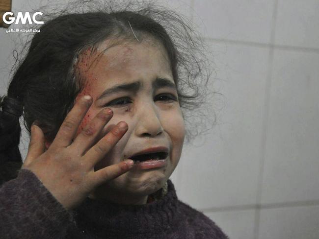 A young Syrian girl wounded during air strikes and shelling by Syrian government forces, cries at a makeshift hospital. Picture: Ghouta Media Center/AP