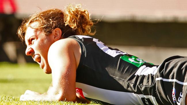 Tim Broomhead feels the pain of his badly broken leg earlier this season. Picture: Getty Images