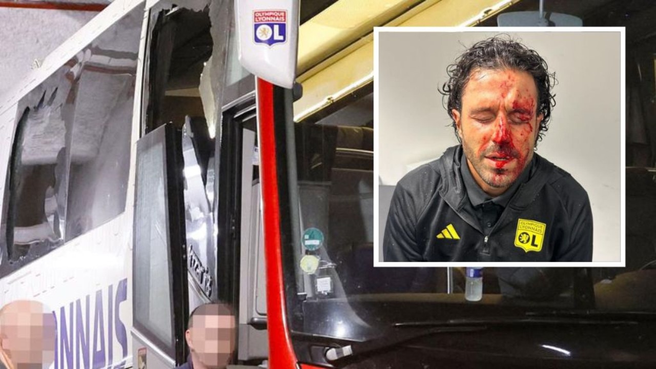 Coach injured, match abandoned after bus attack in French football