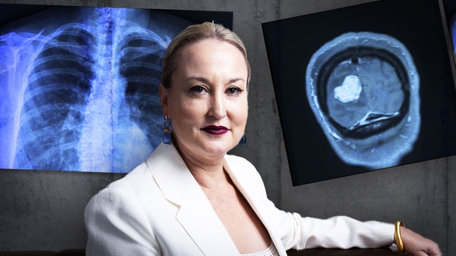 Margaret Lawson has been diagnosed with stage four lung cancer, despite never having smoked.