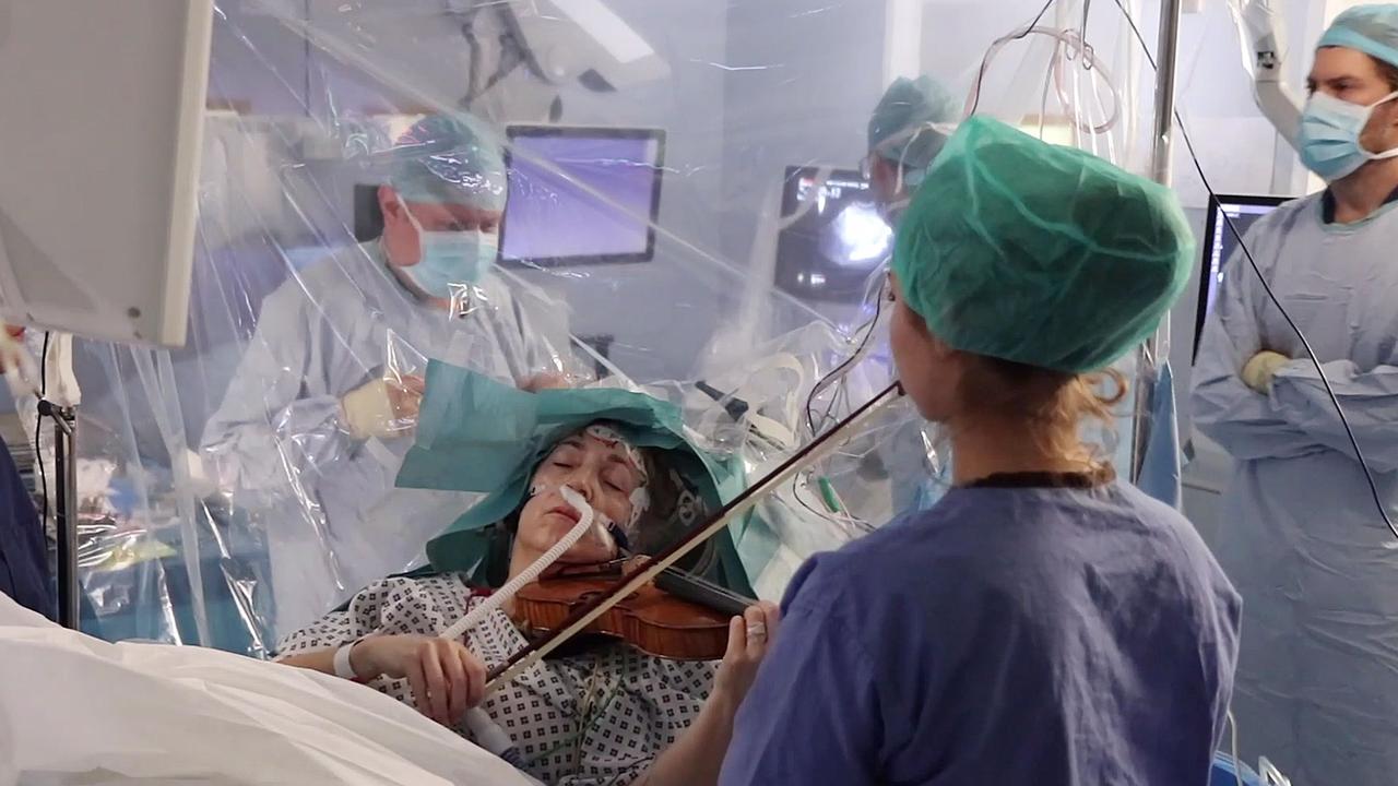 A still image take from video by King’s College Hospital, London, UK, showing musician Dagmar Turner playing the violin during brain surgery. Picture: AFP/King’s College Hospital