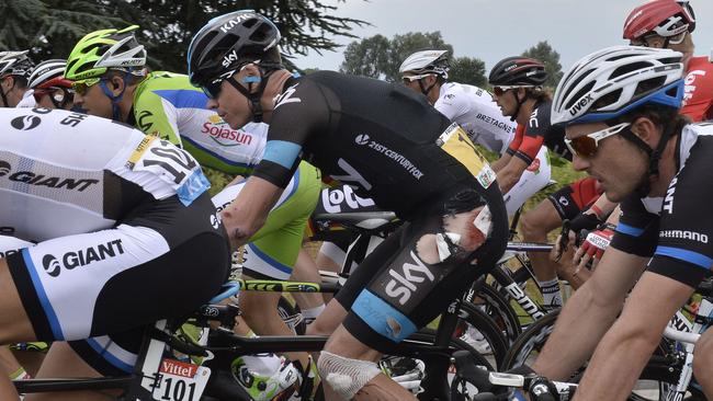 Chris Froome bears some nasty cuts after his early Tour crashes.