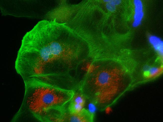 The placenta cells (in green) that are infected with the SARS-CoV-2 virus (COVID-19, in red). In blue are cell nuclei.