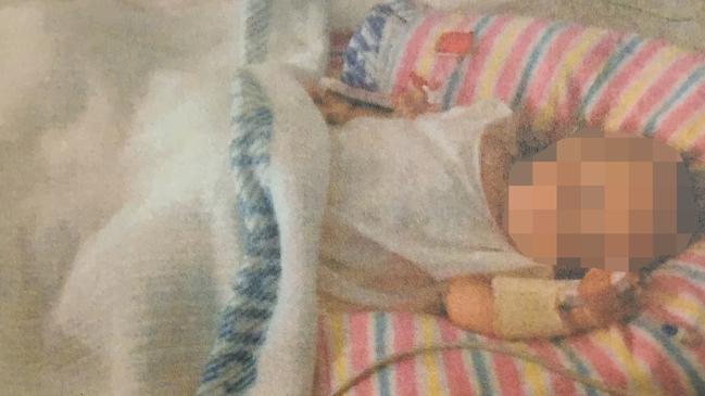 An image, supplied as evidence, of the baby girl fed a vegan diet by her parents who was so malnourished at 19 months old she didn't have any teeth and looked like she was just three months. Picture: AAP