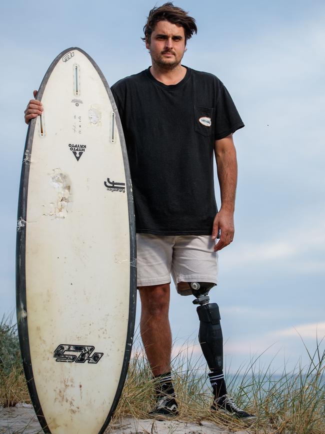 Shark attack survivor Chris Blowes at West Beach on December 11, 2020. Chris is holding the board he was on when a great white took his leg in 2015. Picture Matt Turner