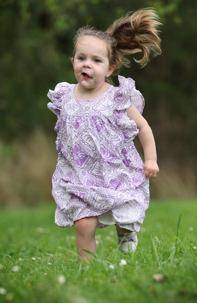 Maisie, 2, has a rare condition called lymphatic malformation. Picture: David Caird