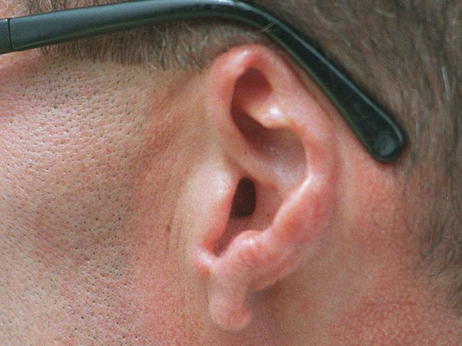 Mark “Chopper” Read in 1979 with sunglasses resting on his mutilated ear. Picture: Craig Borrow