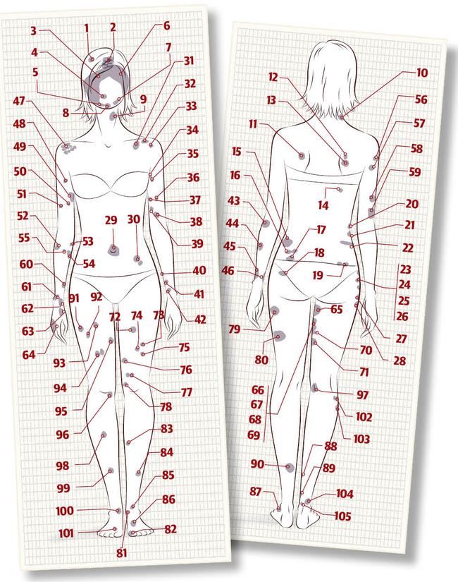 Locations of the 105 bruises on Kirra McLoughlin’s body